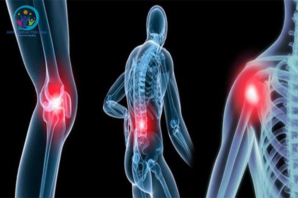 Đại cốt đan sử dụng cho đối tượng gặp vấn đề về xương khớp